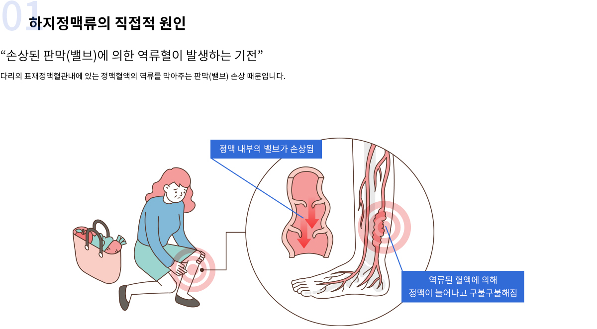 원인증상